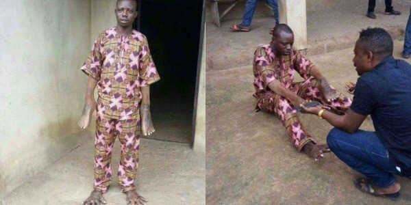 Man Had His Hands And Legs Switched After Sleeping With Someone's Wife