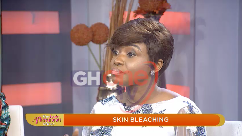 I went blind from bleaching my skin - Woman reveals